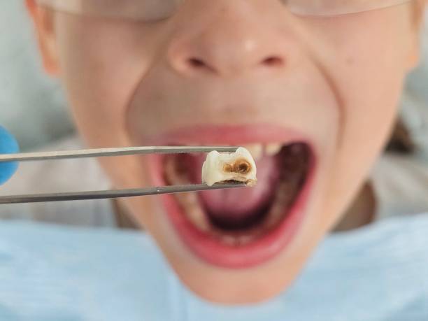 Best Walk-In Emergency Dentist in Richton, MS